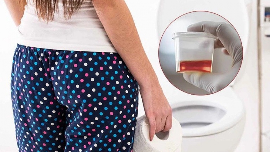 Sinh con được gần 2 năm, người phụ nữ bị tiểu ra máu nhiều lần