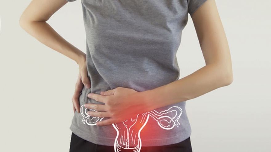 U xơ tử cung để lâu có bị chuyển thành u ác tính hay không?