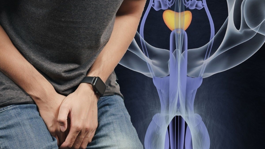 Những dấu hiệu cần lưu ý vì đó có thể là chỉ dấu bệnh ung thư tinh hoàn