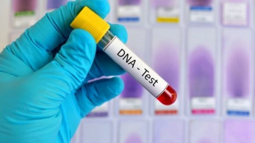 Nghi ngờ 2 đứa không phải con ruột, tôi muốn đi xét nghiệm ADN để xác minh