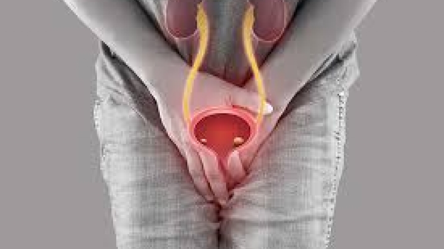 55 tuổi, huyết áp cao nhưng vẫn "quan hệ" ngày 3 lần