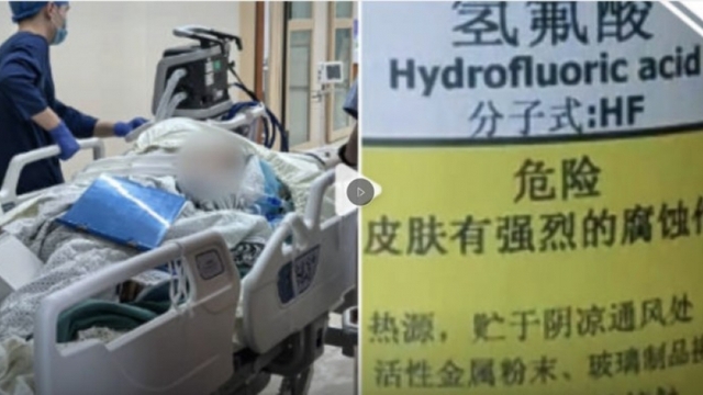 Giẫm phải "nước hòa tan xương" khi đi dạo, người phụ nữ chết sau 5 ngày