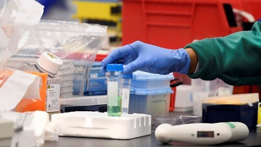 Vaccine ngăn ngừa Covid-19 của Nga có giá bao nhiêu?