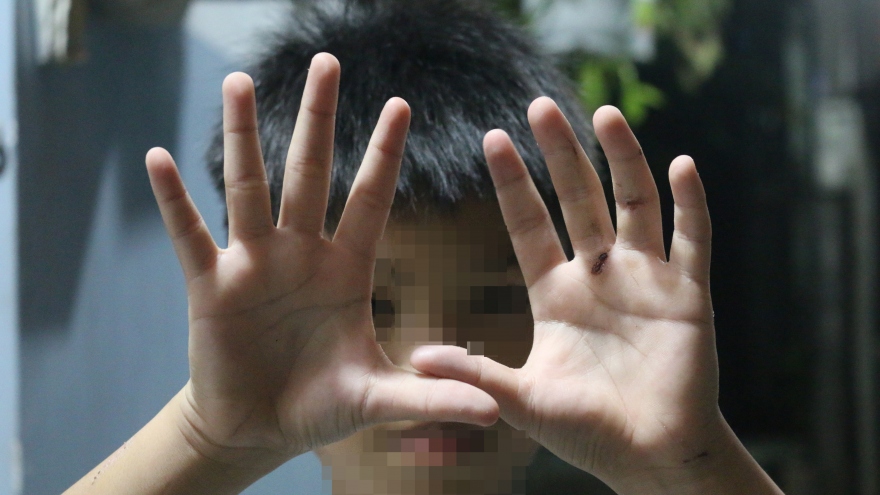 Có hay không bé trai ở Hóc Môn bị cha ruột đánh nát tay, bắt đi bán vé số?