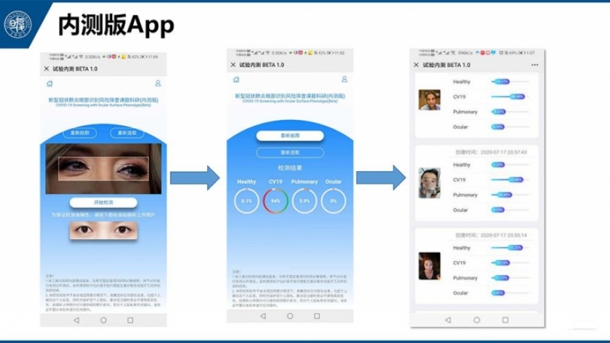 Trung Quốc phát triển công nghệ phát hiện nguy cơ mắc Covid-19 qua kiểm tra mắt