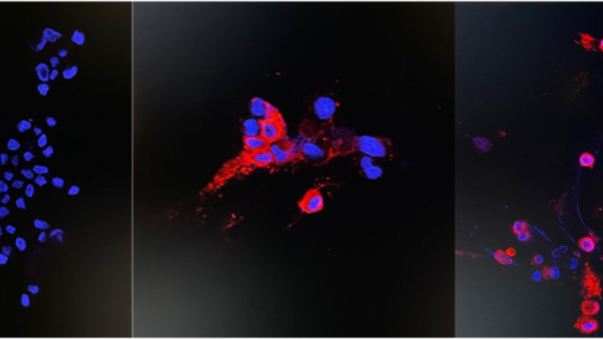 Hong Kong (Trung Quốc) phân lập thành công biến thể Omicron