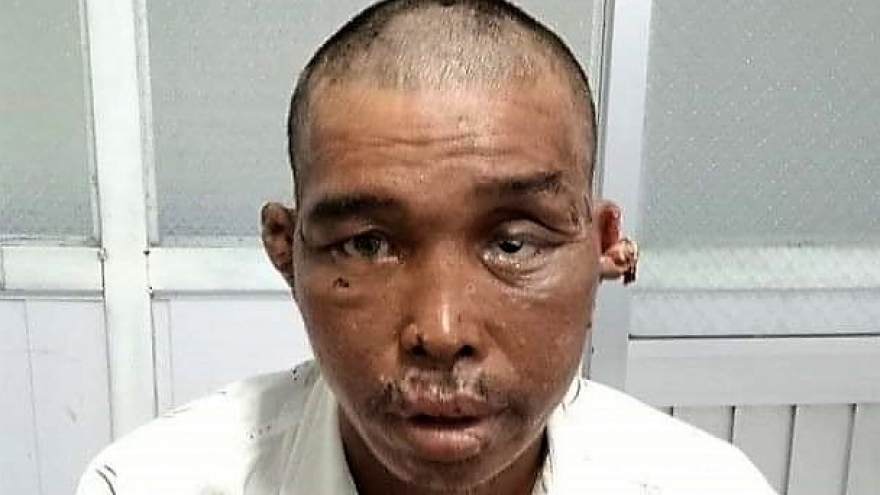 Khởi tố, bắt giam 3 bị can hành hạ dã man 2 người đàn ông trên tàu cá