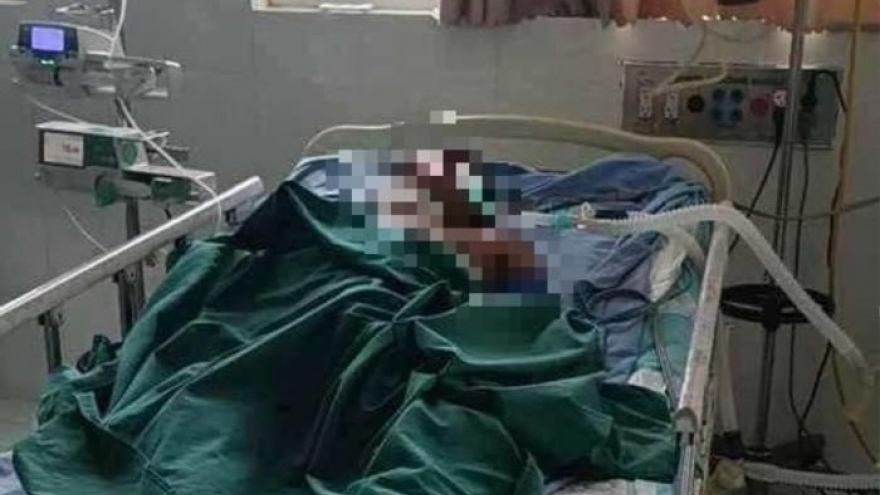 Đi lấy tổ ong mưu sinh, người đàn ông ở Quảng Nam bị ong đốt tử vong