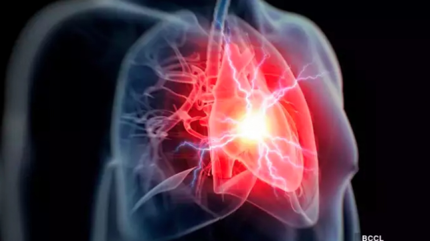 Nguyên nhân gây ngừng tim ở người trẻ tuổi?