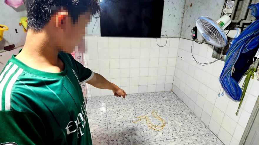 Nóng 24h: Vợ bị chồng chích điện, hành hạ dã man vì ghen tuông