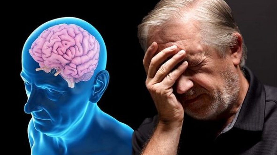 Béo bụng có thể làm tăng nguy cơ mắc Alzheimer