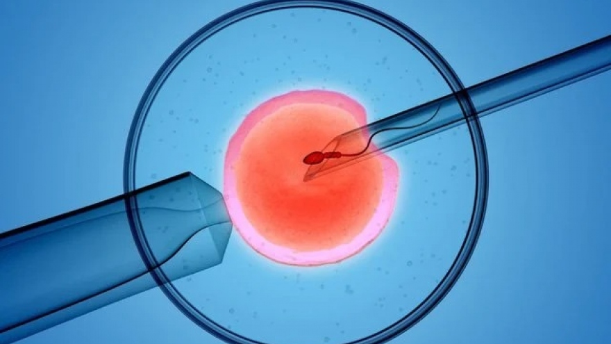 Đa nang buồng trứng có làm thụ tinh nhân tạo được hay không?