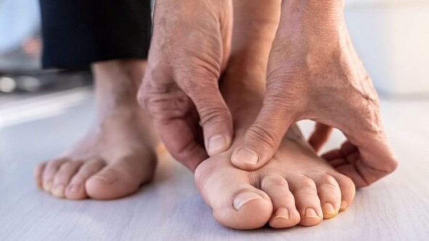 5 dấu hiệu ở bàn chân cảnh báo bệnh tim bạn tuyệt đối không được bỏ qua