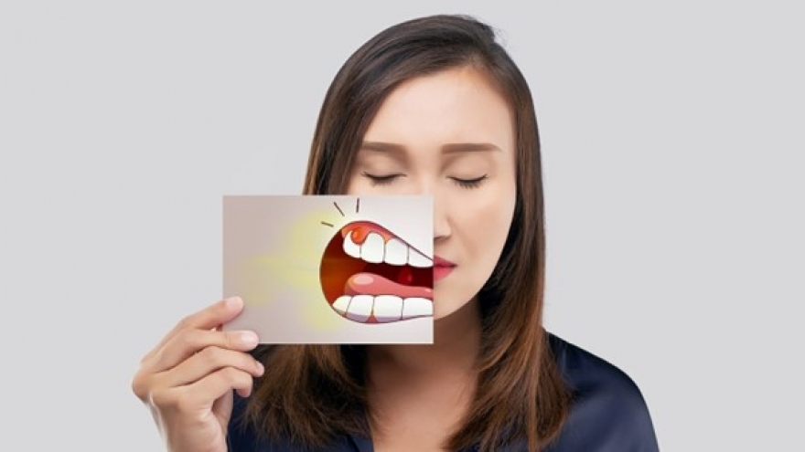 5 dấu hiệu trên miệng "cảnh báo" gan đang suy yếu không phải ai cũng biết