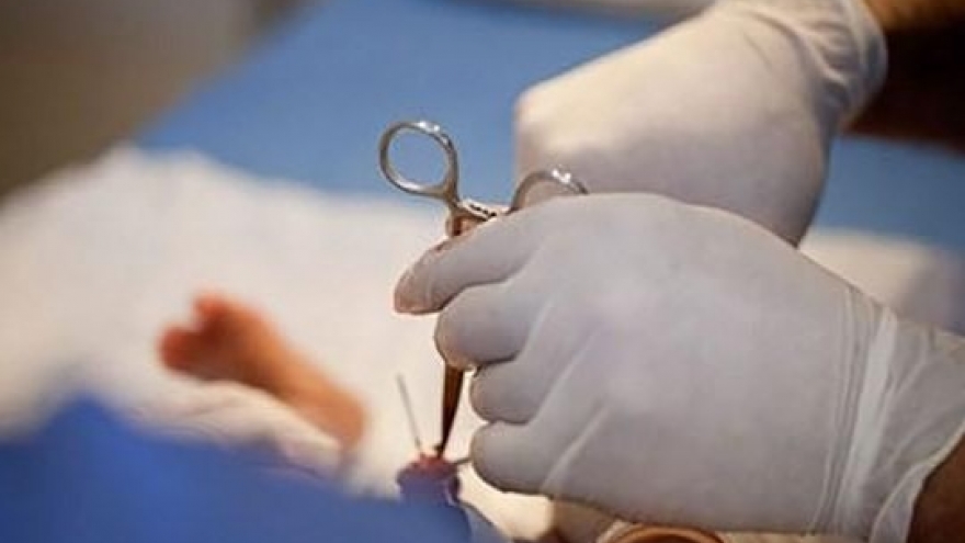 Mổ u xơ tiền liệt tuyến có bị tái phát lại không?