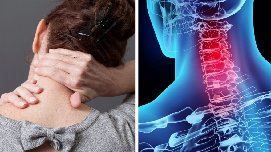 Hậu quả khôn lường từ thói quên bẻ, lắc cổ nhưng không phải ai cũng biết