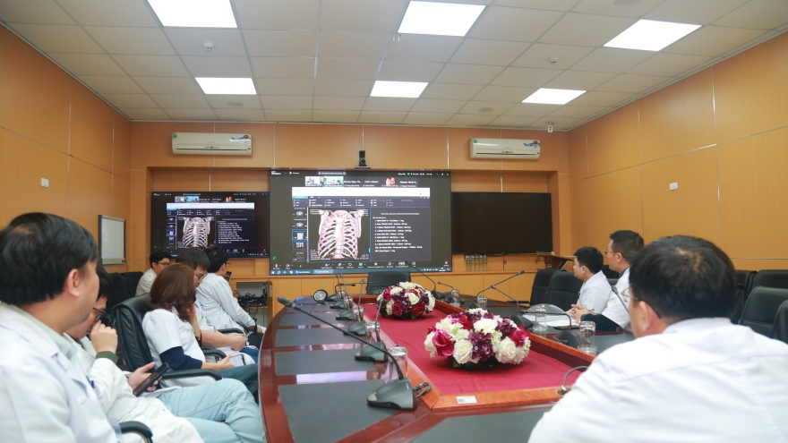 Bệnh viện Việt Đức cấp cứu các nạn nhân đa chấn thương trong vụ tai nạn ở Sơn La