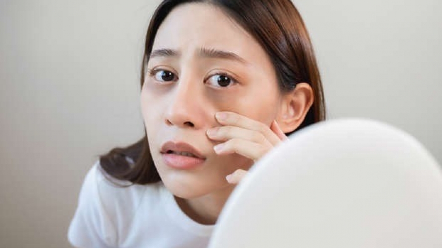 Loạt dấu hiệu trên da cho thấy gan đang suy yếu, cần đi khám ngay