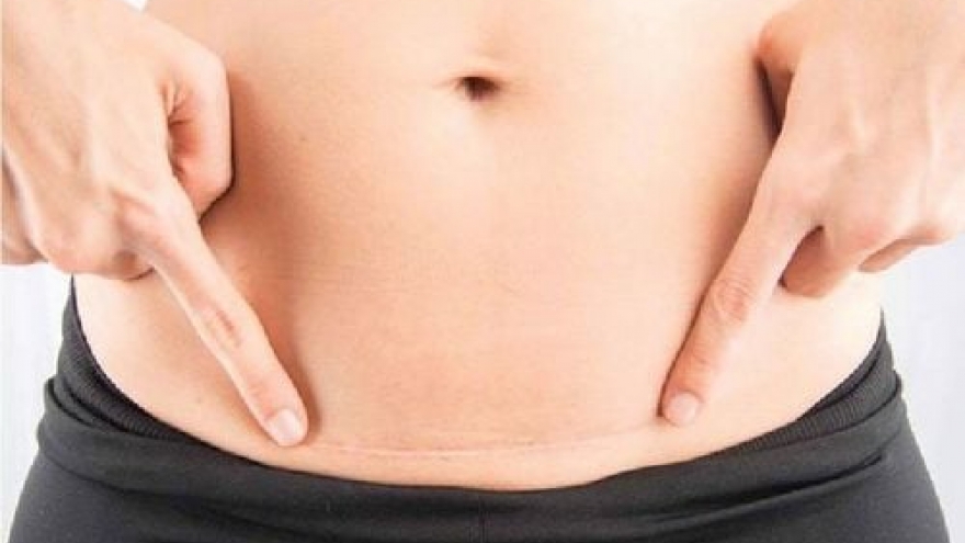 Sinh mổ lần 3 có nguy hiểm cho mẹ và bé hay không?