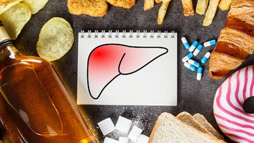 Những thực phẩm tưởng vạn người mê lại là "kẻ thù số 1" của lá gan