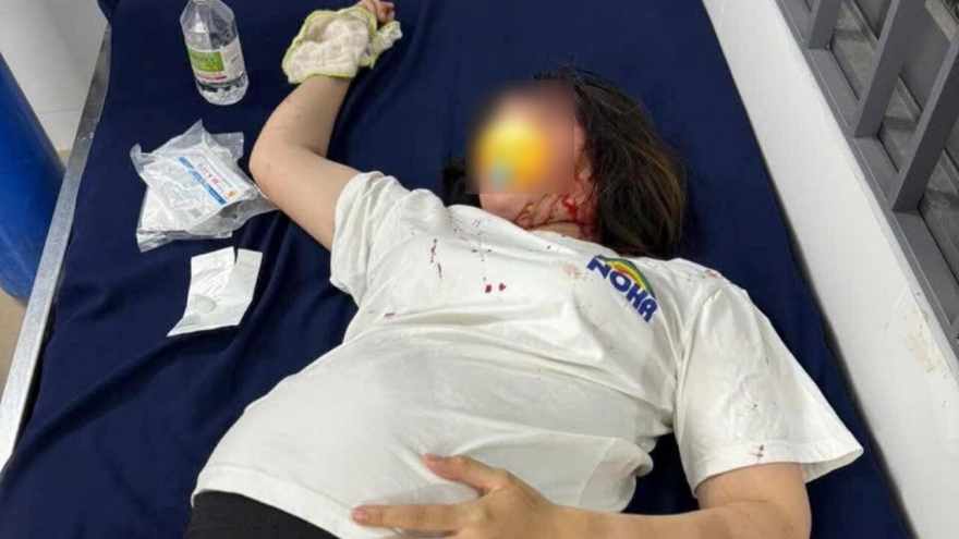 Một phụ nữ mang bầu ở Đồng Nai bị ngất xỉu do xô xát tại khu vui chơi trẻ em