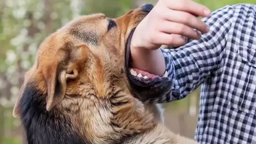 Người đàn ông Bắc Kạn có dấu hiệu lên cơn dại sau gần 4 tháng bị chó cắn