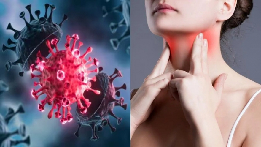 Biến thể NB.1.8.1 gây đau họng như “dao cứa" ở bệnh nhân COVID-19 tại Mỹ