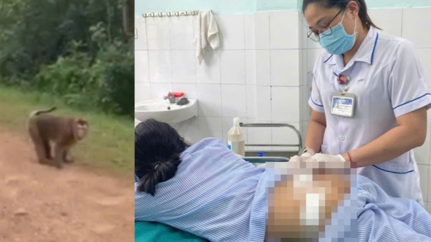 Khỉ tấn công người làm cháu bé 10 tuổi nhập viện tại Quảng Trị