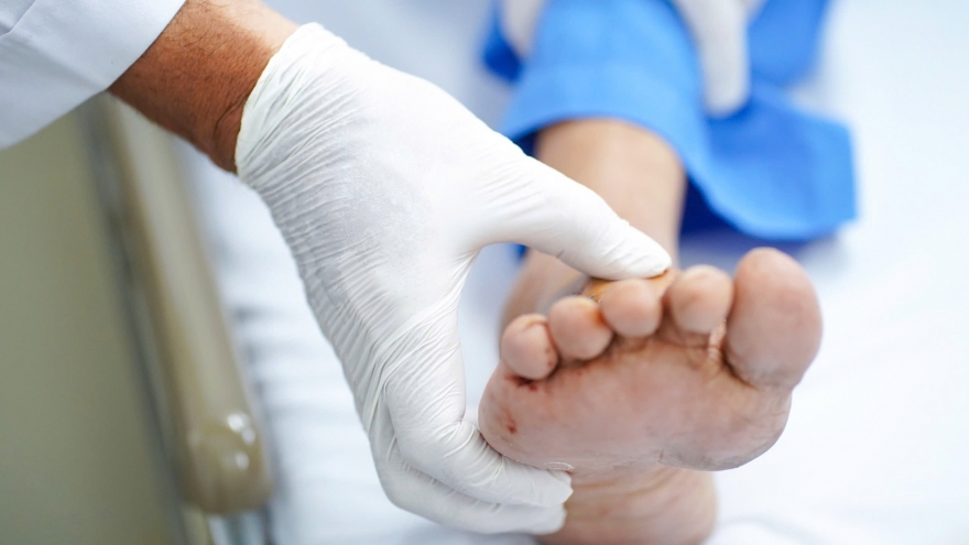 Phẫu thuật lấy dị vật trong mu bàn chân, cứu thầy giáo khỏi cơn đau kéo dài