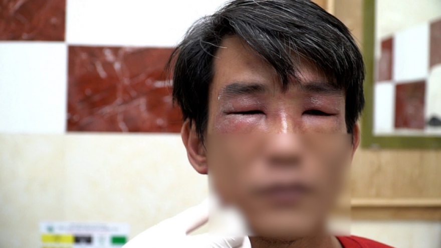 TP.HCM: Kiến ba khoang lại tấn công người, bác sĩ cảnh báo chữa trị bằng 'mẹo'