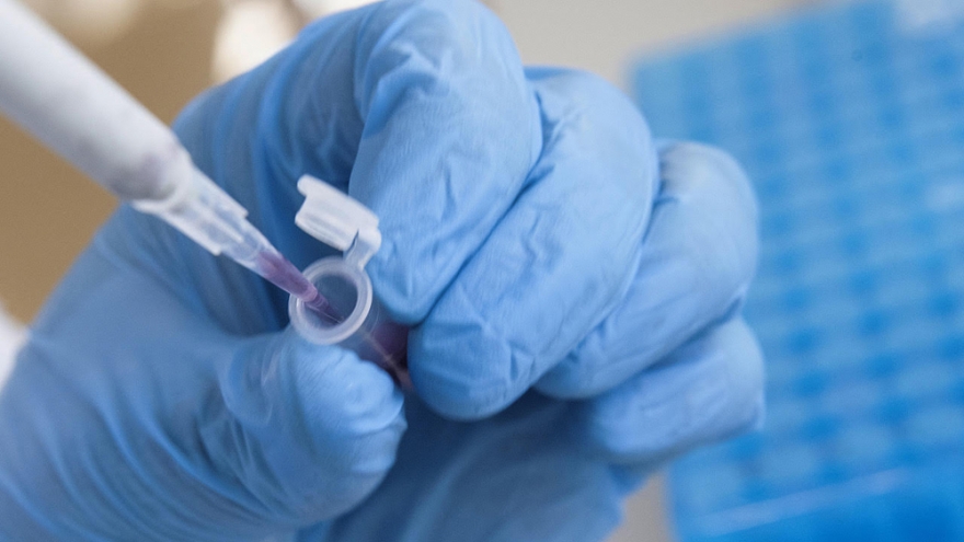 Belarus ghi nhận hơn 1000 trường hợp mắc Covid-19