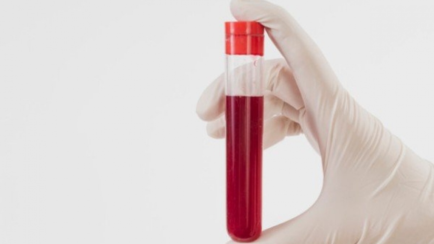 Lợi và hại từ việc hiến máu tình nguyện