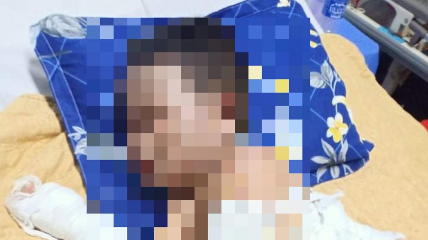 Công an vào cuộc vụ ném bom xăng khiến hai bé trai bỏng nặng