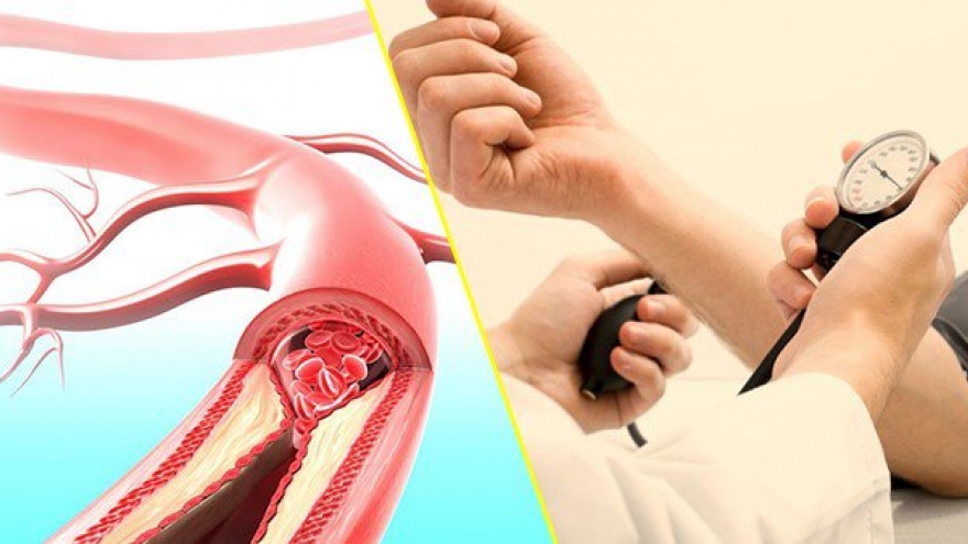 Nạn nhân của “kẻ giết người thầm lặng” đang ngày càng trẻ hóa