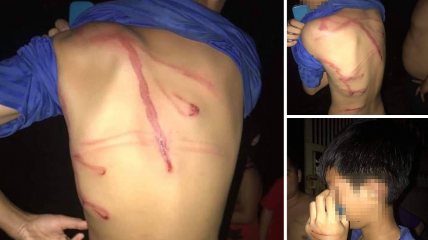 Công an tỉnh Bình Phước thông tin vụ cha bạo hành con ruột