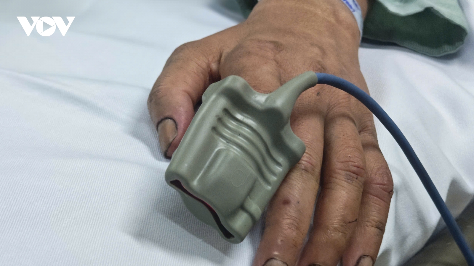 Nạn nhân vụ cháy quán cà phê được chuyển đến BV Bạch Mai tiếp tục điều trị