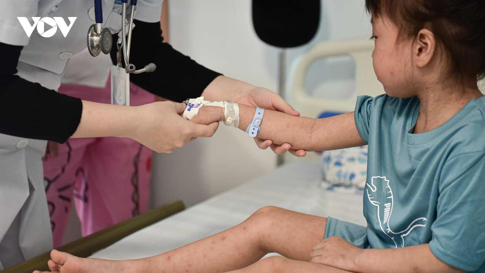 Bệnh viện liên tục tiếp nhận ca mắc sởi, nhiều bệnh nhi gặp biến chứng nguy hiểm