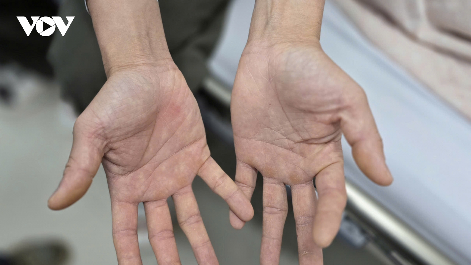 Sử dụng bóng cười: Từ phút “phê” đến cả đời tàn phế