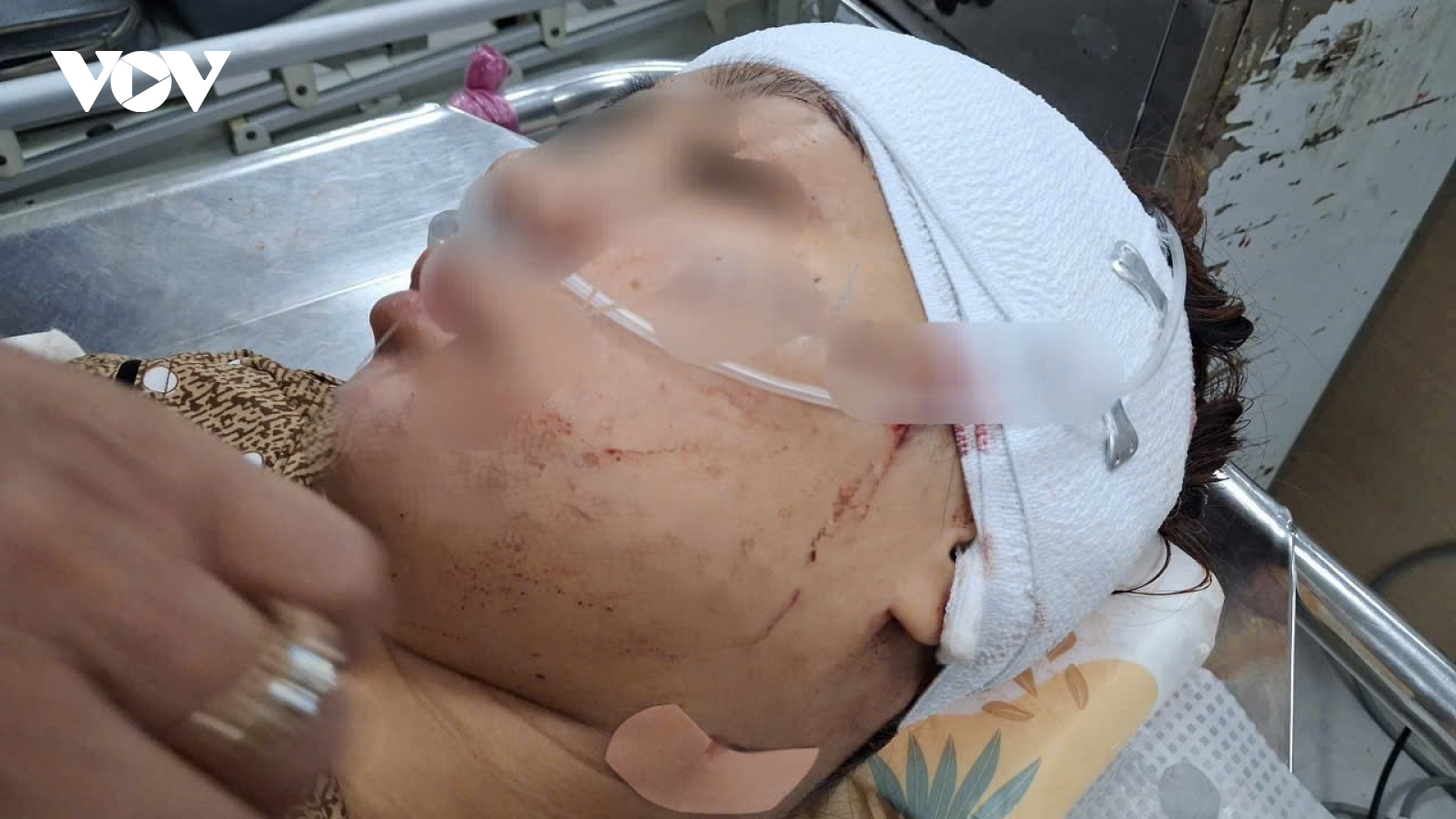 Nóng 24h: Rạch mặt “tình địch” bằng dao rọc giấy