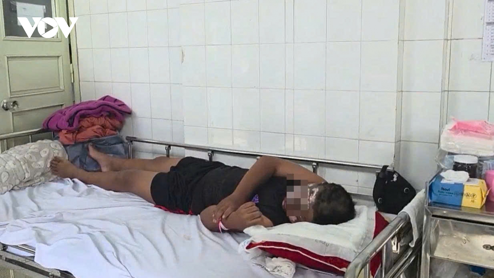 Bé trai 13 tuổi bỏng nặng vùng mặt do chơi pháo nổ