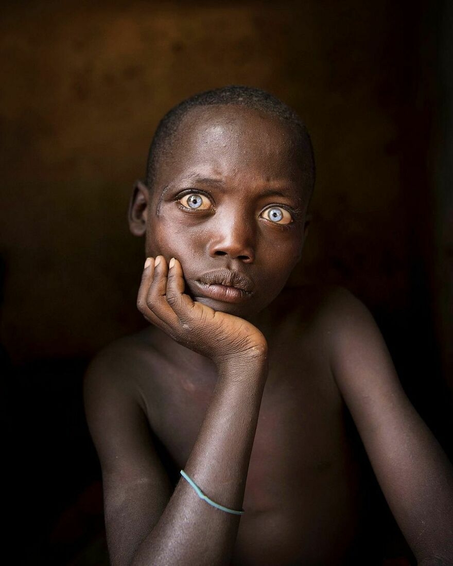 Gương mặt suy tư của một cậu bé ở Ethiopia.