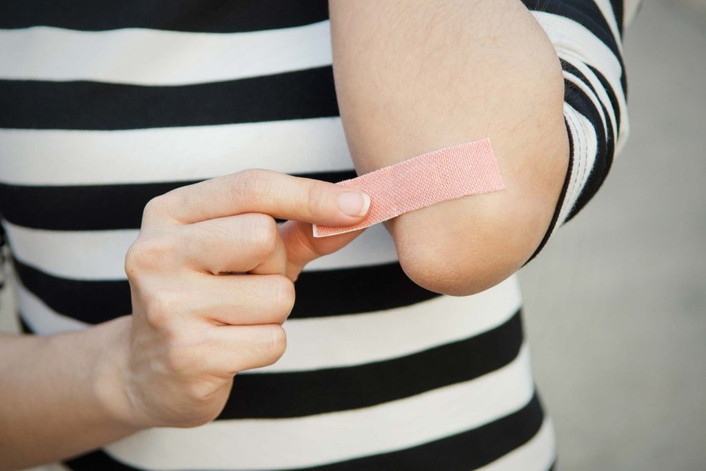 Vết thương chảy mủ xanh hoặc có mùi: Nếu bạn thấy vết thương chảy mủ màu xanh và/hoặc có mùi lạ, đó là dấu hiệu chắc chắn cho thấy vết thương đã bị nhiễm trùng. Vết thương hở bình thường sẽ tiết dịch màu vàng gọi là huyết tương, giúp bảo vệ vết thương.