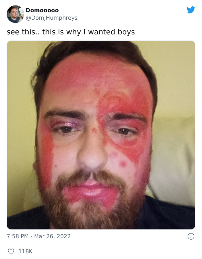 Ông bố đăng bức ảnh nhem nhuốc do bị con gái yêu tô vẽ, kèm lời nhắn hài hước: "Nhìn xem, đó là lý do vì sao tôi muốn có con trai".