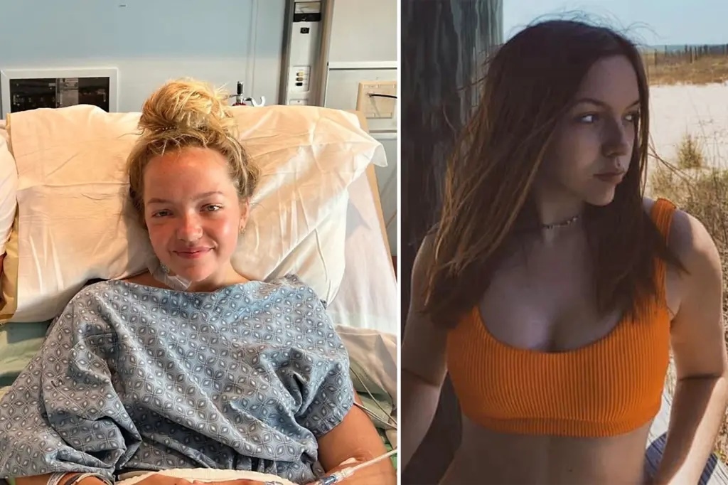 Hình ảnh cô Addison Bethea tại bệnh viện sau khi bị cá mập tấn công (bên trái) và trước khi bị cá mập tấn công. Ảnh: New York Post.