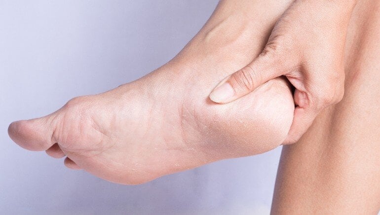 2. Chữa lành gót chân nứt nẻ: Gót chân bị nứt chắc hẳn phải rất khó chịu. Hiện tượng này xảy ra khi vùng da xung quanh gót chân của bạn bị khô và cứng quá mức. Khi đó, bạn có thể sử dụng dầu dừa để chữa nứt gót chân. Để hiệu quả hơn, người ta sẽ xoa bóp dầu dừa lên gót chân mình. Nếu gót chân nứt nẻ bị chảy máu hoặc nhiễm trùng, các chất chống viêm và kháng khuẩn của dầu dừa sẽ giúp bạn chữa lành chúng.