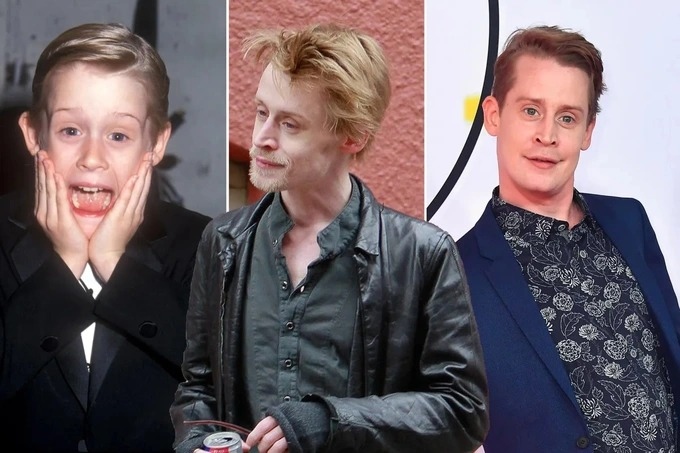 Macaulay Culkin đã có lúc hom hem, tiều tụy (ảnh giữa) ở mức độ gây lo ngại và làm dấy lên những tin đồn rằng anh đang bị... bệnh nặng, sắp qua đời (Ảnh: Page Six).