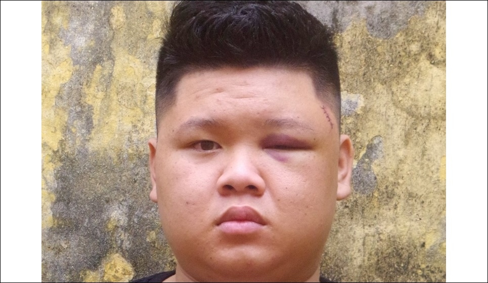 Bị can Lừu Quốc Huy