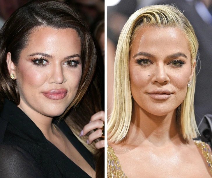 Khlóe Kardashian là một trong những ngôi sao truyền hình thực tế nổi tiếng và giàu có nhất nước Mỹ hiện nay. Ở tuổi 40, Khlóe Kardashian rất khác lạ so với những hình ảnh của cô cách đây hơn 10 năm. Khlóe Kardashian thừa nhận cô đã sửa mũi cách đây 6 năm và cảm thấy mệt mỏi với những tin đồn cho rằng cô đã "cấy ghép" khuôn mặt nên ngoại hình ngày càng thay đổi. Người đẹp cho biết, hình ảnh của cô thay đổi đáng kể vì cô đã giảm 14 kg trong vài năm trở lại đây. Ngoài ra, cô còn thay đổi màu tóc và kiểu trang điểm. 