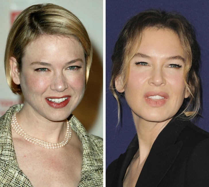 Có tin đồn rằng Renée Zellweger đã trải qua nhiều cuộc phẫu thuật thẩm mỹ, đó là lý do khiến các đường nét trên khuôn mặt của cô thay đổi hoàn toàn. Sự lột xác của nữ diễn viên khiến giới truyền thông bàn tán sôi nổi. Bản thân diễn viên "Nhật ký tiểu thư Jones" nói cô không để ý đến vẻ ngoài và không nhận ra sự thay đổi như nhiều người vẫn thấy. Tuy nhiên, nhìn vào bức ảnh của cô, các bác sĩ thẩm mỹ đoán rằng cô đã thực hiện nhiều tiểu phẫu như nâng cơ mặt, cơ mắt, phẫu thuật độn cằm.
Tuy đó là nỗ lực để nữ diễn viên giữ gìn vẻ đẹp nhưng không may rằng đây là một sự thất bại, trông cô già hơn so với tuổi, gương mặt cứng nhắc nhiều nếp nhăn và có vẻ như phần bầu mắt trên gương mặt đã hoàn toàn biết mất.