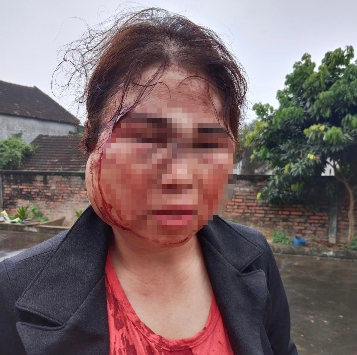 Bà M thời điểm ra khỏi căn phòng với nhiều vết thương trên khuôn mặt